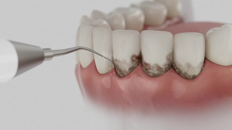 Trusted Teeth Cleaning And Checkup service in Koloa, HI - Dentist Open Now